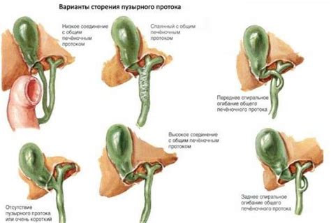 Диагностика негомогенного содержимого желчного пузыря