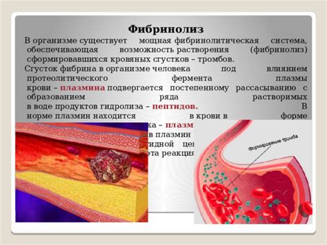 Медицинские состояния, связанные с образованием тромбов