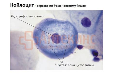 Неоконченный фагоцитоз в мазке у женщин