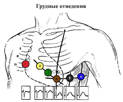 Низковольтное ЭКГ: назначение и принцип проведения