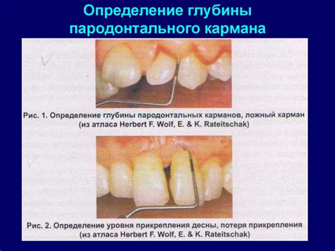 Определение горячего кармана