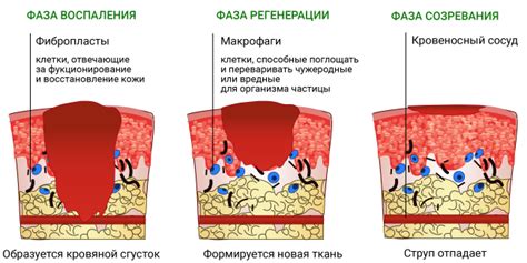 Основные причины возникновения ран от щетиной