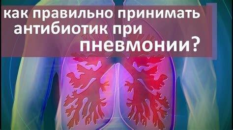 Практика использования горячего укола при пневмонии