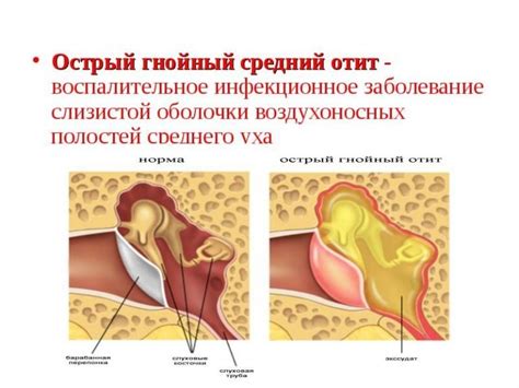 Симптомы и возможные причины боли в ухе после чистки