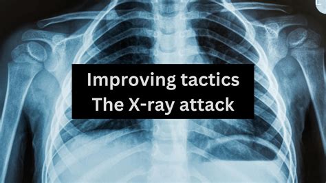 X-Ray Attack